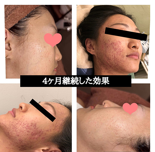 ビフォーアフター